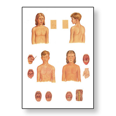 Infectious Diseases Chart