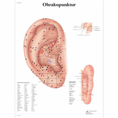 Ohrakupunktur, 4006650 [VR0821UU], Acupuncture accessories