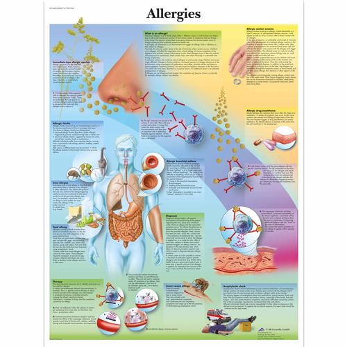Allergies Chart, 4006715 [VR1660UU], Asthma and Allergies Education