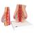 Model of Female Breast with Healthy & Unhealthy Tissue - 3B Smart Anatomy, 1008497 [L56], Breast Models (Small)