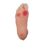 Diabetic Foot Model, 1017936 [W43107], Diabetic Teaching Tools