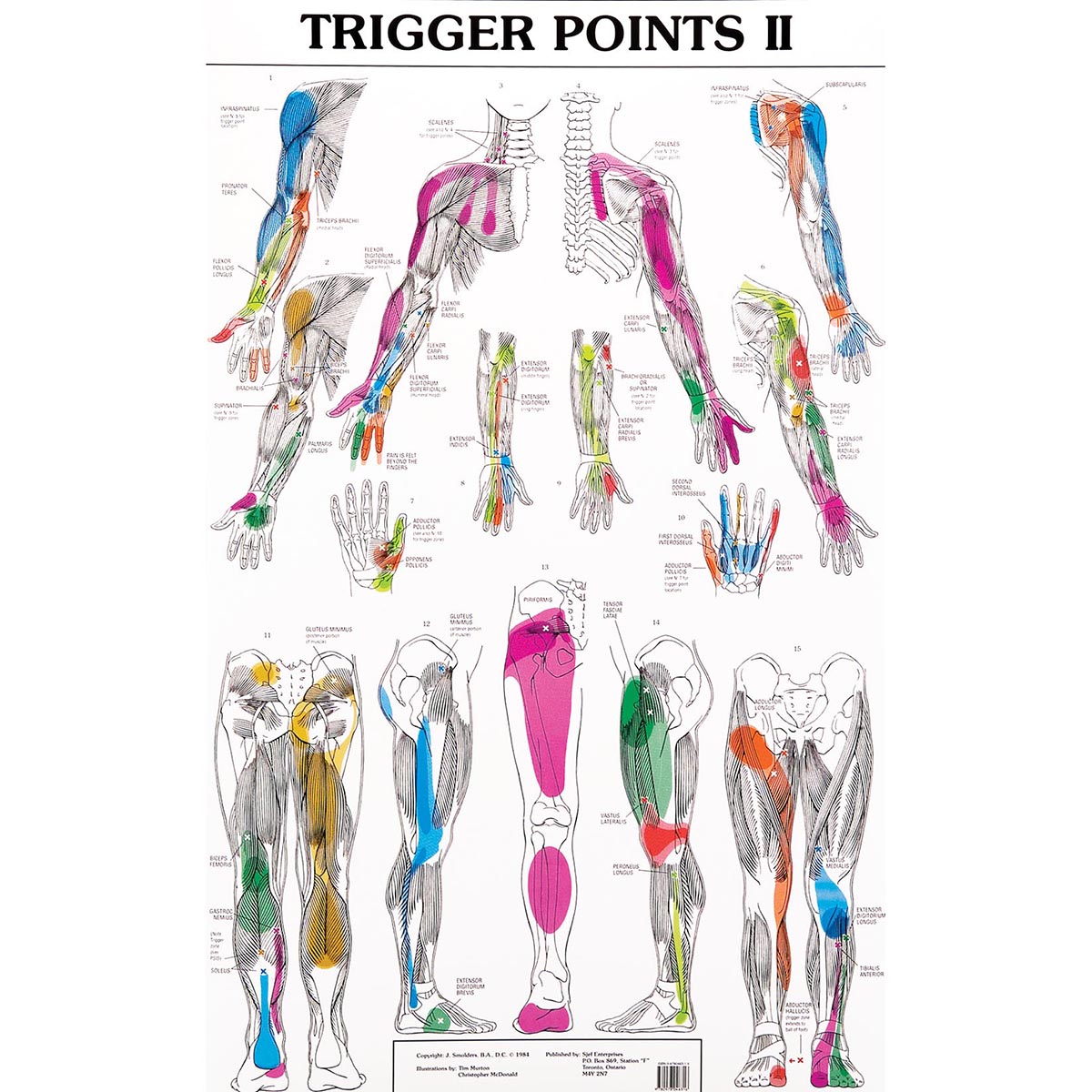 Set of Trigger Point Charts W99990 Acupuncture 3B Scientific