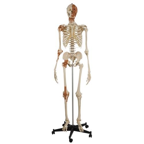 Skeleton with 4 ligaments, head and neck muscles, 1019415, Skeleton Models - Life size