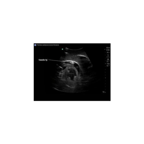 Blue Phantom Transthoracic Echocardiography and Pericardiocentesis Ultrasound Training Model, 3012521, Transesophageal Echocardiography (TEE)
