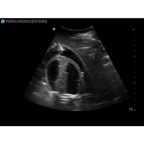Blue Phantom TTE Ultrasound Training Platform Without optional Head, 3012528, Transesophageal Echocardiography (TEE)