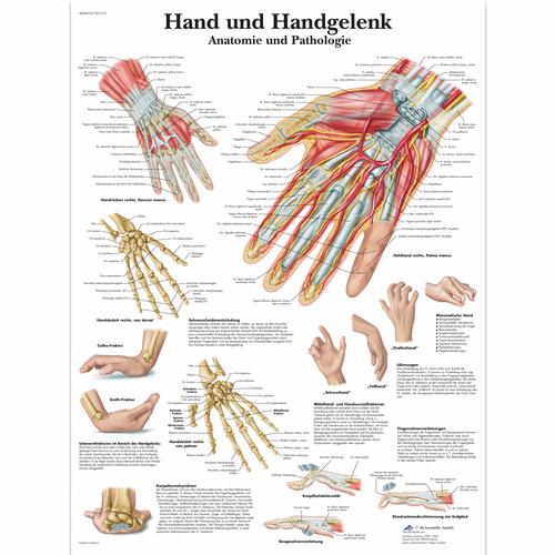 Hand und Handgelenk - Anatomie und Pathologie, 4006576 [VR0171UU], Skeletal System