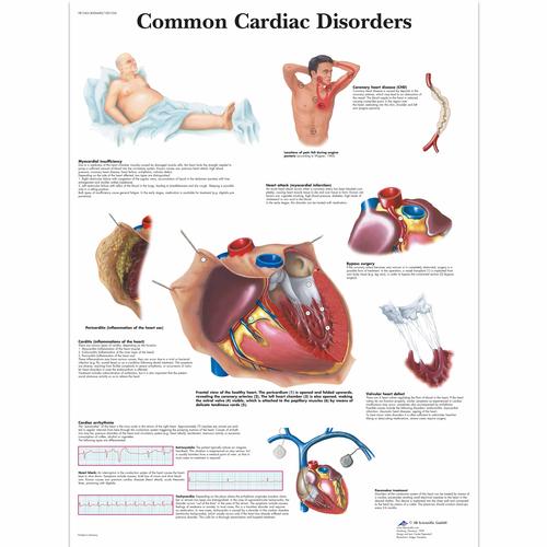 Common Cardiac Disorders Chart, 4006680 [VR1343UU], Heart Health and Fitness Education