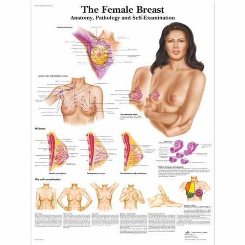Female Breast Chart - Anatomy, Pathology and Self-Examination, 1001576 [VR1556L], Women's Health Education