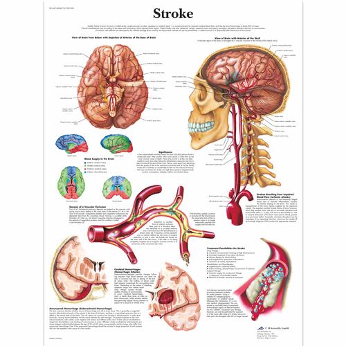 Anatomical Charts - Neurological Posters - Pathology Posters