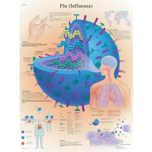 Flu (Influenza) STICKYchart™ 
, VR1722S, Parasitic, Viral or Bacterial Infection