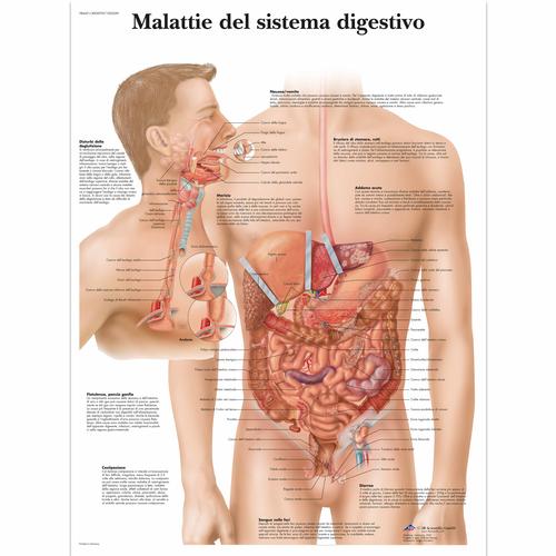 Malattie del sistema digestívo, 4006939 [VR4431UU], Digestive System