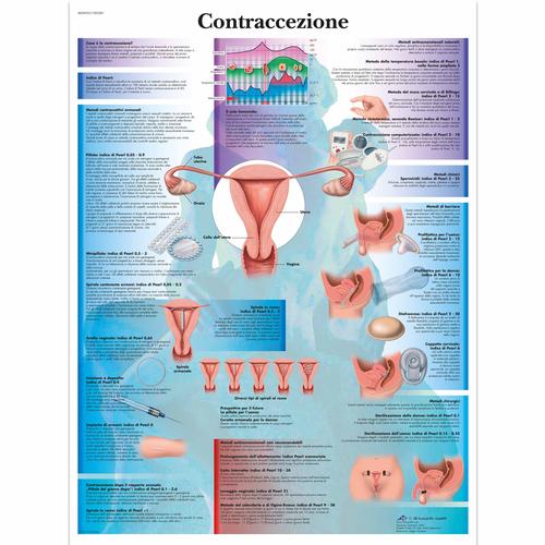 Contraccezione, 4006955 [VR4591UU], Gynaecology