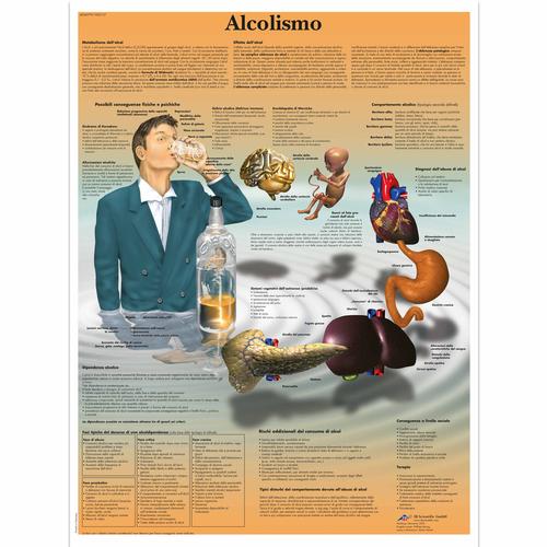 Alcolismo, 4006979 [VR4792UU], Addiction