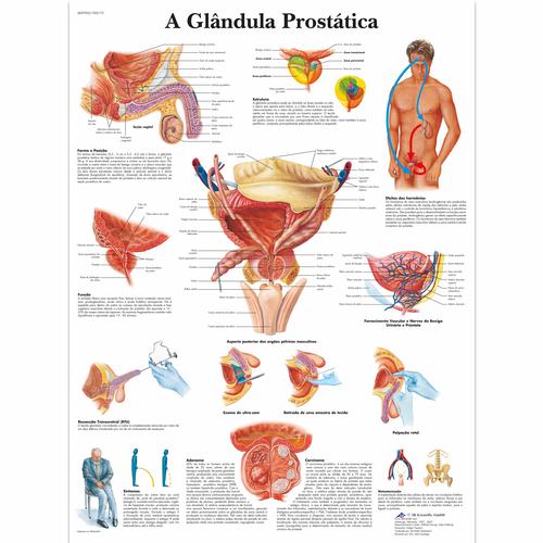 A glândula Prostatica, 50x67 cm, Versao Papel, 4007002 [VR5528UU], Urinary System
