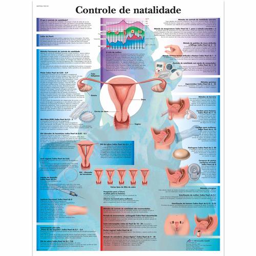 Controle de natalidade, 50x67 cm, Laminado, 1002181 [VR5591L], Gynaecology