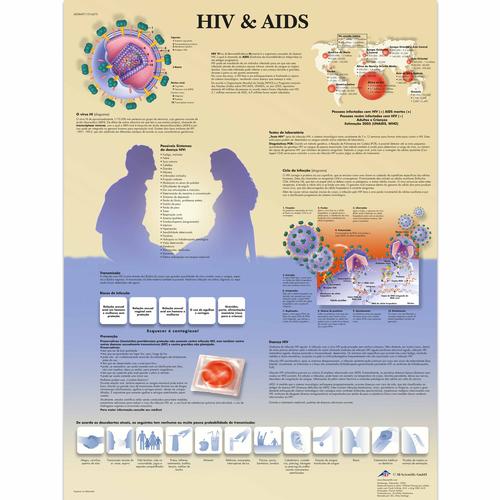 HIV and AIDS Chart, 1016675 [VR5725L], Sex Education