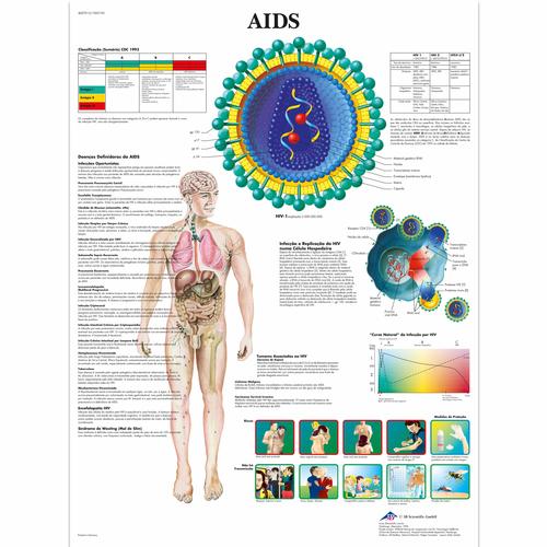 AIDS, 50x67 cm, Laminado, 1002195 [VR5727L], Parasitic, Viral or Bacterial Infection
