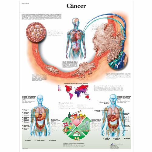 Câncer, 50x67 cm, Laminado, 1002197 [VR5753L], Cancers