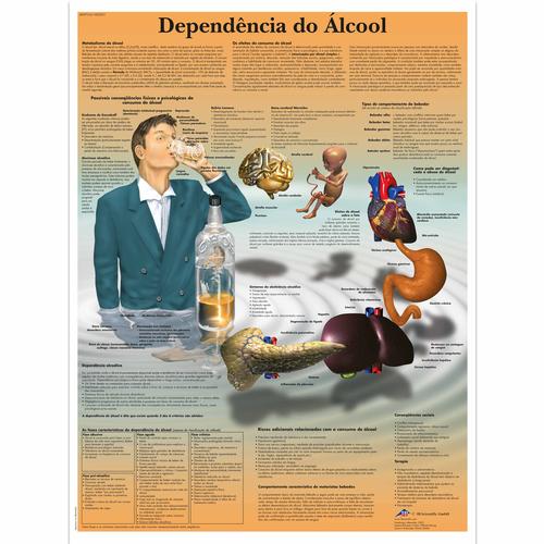 Dependência do alcool, 50x67 cm, Versao Papel, 4007016 [VR5792UU], Addiction