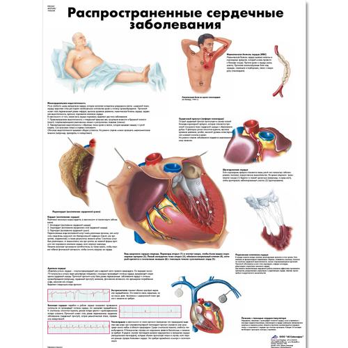 Cardiac Anatomy Chart