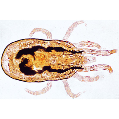 Arachnoidea and Myriapoda - Spanish, 1003866 [W13005S], Microscope Slides LIEDER