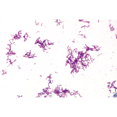 Bacteria, Basic Set - German Slides, 1003884 [W13011], Microscope Slides LIEDER