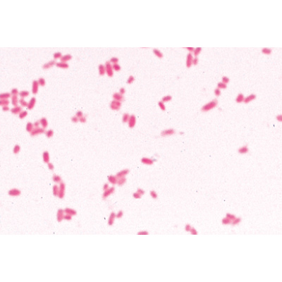 Bacteria, Basic Set - French, 1003885 [W13011F], Microscope Slides LIEDER