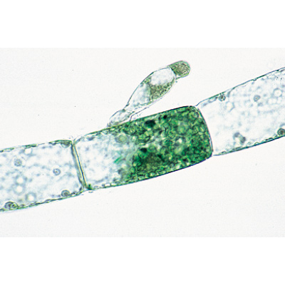 Algae - German Slides, 1003888 [W13012], Microscope Slides LIEDER