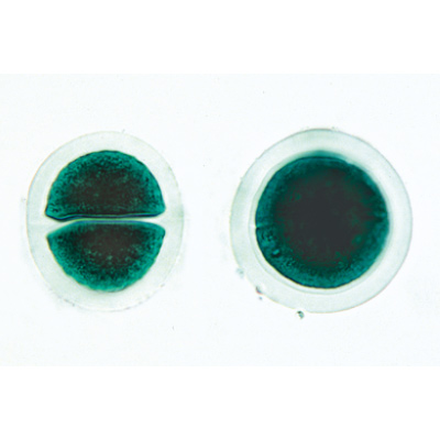 Algae - French, 1003889 [W13012F], Microscope Slides LIEDER