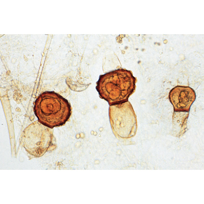 Fungi and Lichen - French, 1003893 [W13013F], French