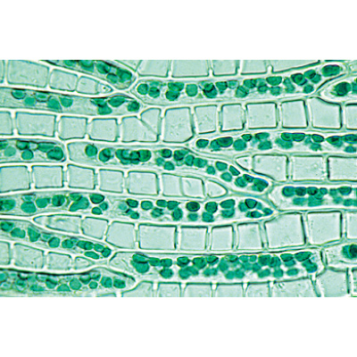 Bryophyta (Liverworts and Mosses) - German Slides, 1003896 [W13014], German