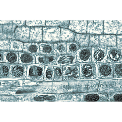 Angiospermae II. Cells and Tissues - German Slides, 1003908 [W13017], German