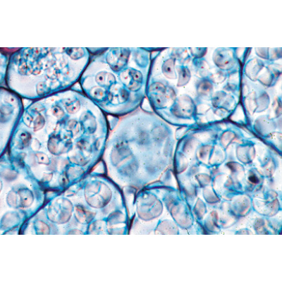 Angiospermae III. Roots - German Slides, 1003912 [W13018], Microscope Slides LIEDER