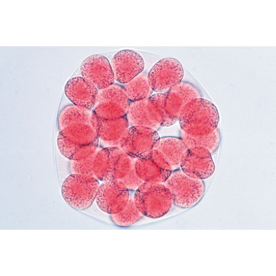 Sea Urchin Embryology (Psammechinus miliaris) - German Slides, 1003944 [W13026], Microscope Slides LIEDER
