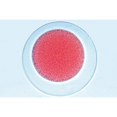 Sea Urchin Embryology (Psammenchinus miliaris) - Spanish, 1003947 [W13026S], Spanish