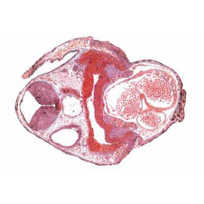 Frog Embryology (Rana) - French, 1003949 [W13027F], Microscope Slides LIEDER