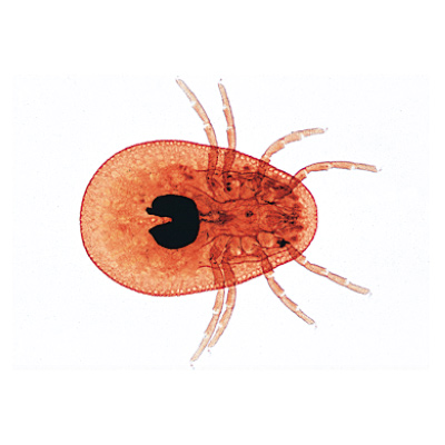 Arachnoidea and Myriapoda - English Slides, 1003964 [W13034], Microscope Slides LIEDER