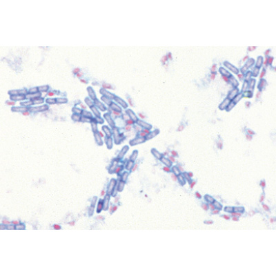 Bacteria Set - 25 Slides, 1003969 [W13040], Microscope Slides LIEDER