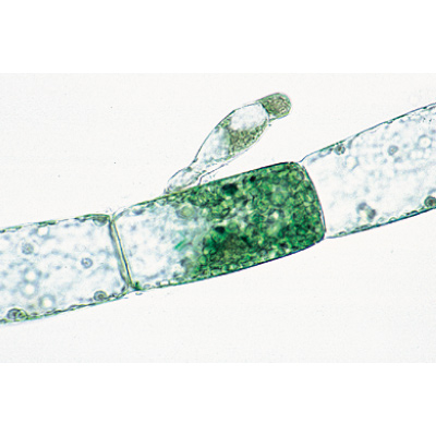 Algae - English Slides, 1003970 [W13041], Microscope Slides LIEDER
