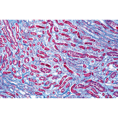 Human Pathology - German Slides, 1004094 [W13311], Microscope Slides LIEDER
