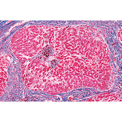 Human Pathology - Portuguese Slides, 1004096 [W13311P], Microscope Slides LIEDER