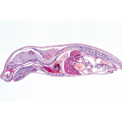 Genital System - French, 1004115 [W13316F], Microscope Slides LIEDER