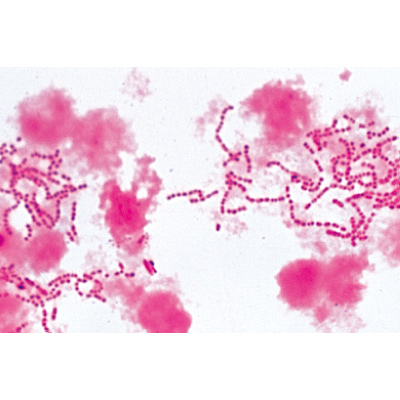 Pathogenic Bacteria - Portuguese, 1004148 [W13324P], Microscope Slides LIEDER