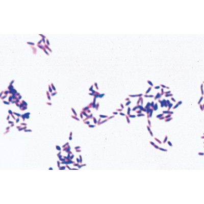Pathogenic Bacteria - Spanish, 1004149 [W13324S], Spanish