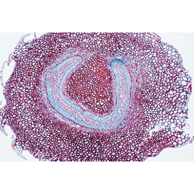 Arrangement and Types of Vascular Bundles - Portuguese Slides, 1004172 [W13330P], Microscope Slides LIEDER