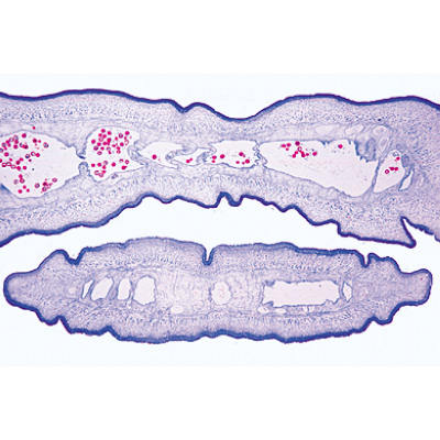 General Parasitology, Short Set - Spanish, 1004216 [W13341S], Microscope Slides LIEDER