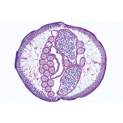 General Parasitology, Short Set - Spanish, 1004216 [W13341S], Microscope Slides LIEDER