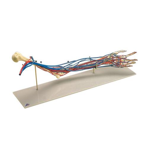Vascular Arm, 1005109 [W19019], Arm and Hand Skeleton Models