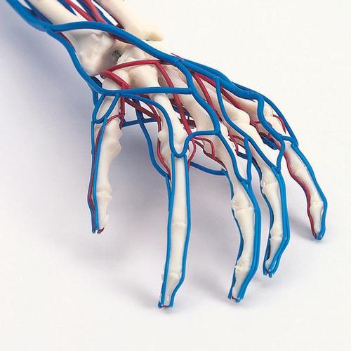 Vascular Arm, 1005109 [W19019], Arm and Hand Skeleton Models