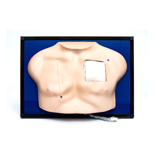 Deluxe Venous Access Device Model, 1005563 [W43007], Injections and Punctures